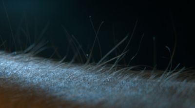 Closeup of the human arm with electrified hair on a dark background.