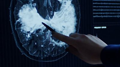 Eine Hand zeigt mit einem Stift auf das Bild eines Gehirnscans.